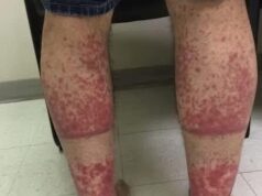 These are the consequences of sleeping with…See more