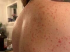 These are the consequences of sleeping with the… See more