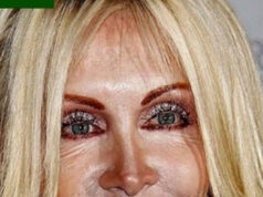 ABSOLUTELY UNRECOGNIZABLEAFTER PLASTIC SURGERY!SHE WAS ONCE A BEAUTIFUL STARWHO IS SHE?