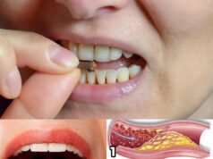 Chewing Cloves Daily: A Habit with Massive Health Benefits