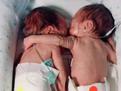 Nurse Puts Dy!ng Baby Next to Her Twin – What Happens Next Becomes a Medical Miracle