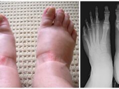 Swollen feet and hands: 10 alarming warning signs you should never ignore