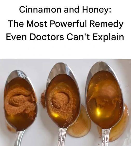 Cinnamon and Honey The Most Powerful Remedy Even Doctors The article in the first comment