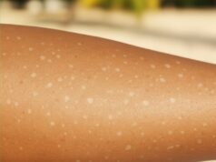 What Vitamin Deficiencies Can Cause White Spots on the Skin