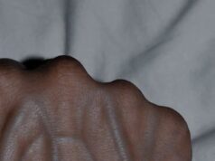 Why Your Veins Become More Visible and What It Means for Your Health