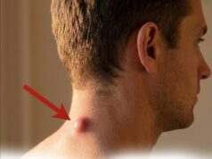 What a Lump on the Neck, Back, or Behind the Ear May Indicate