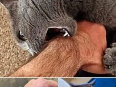 If the cat bites you, here is what it really means!