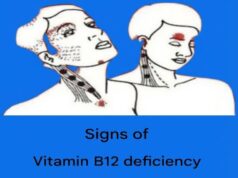 Understanding the Early Signals of Low Vitamin B12 Levels