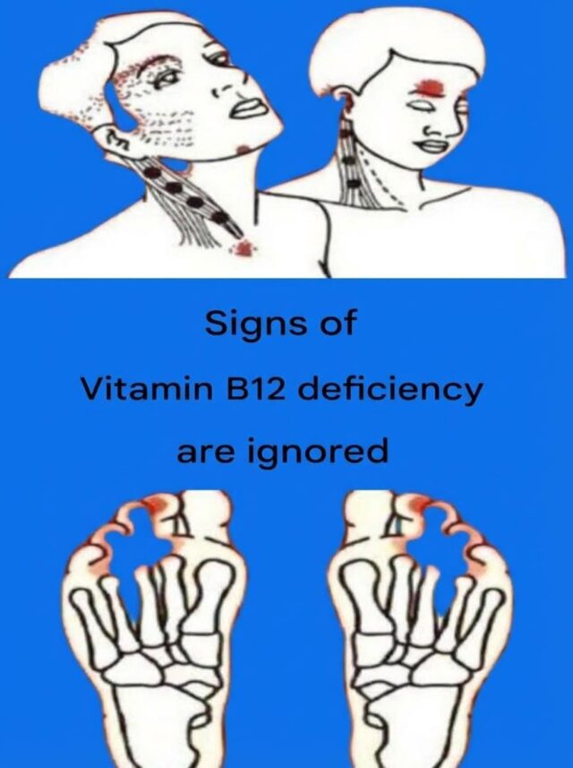 Signs of vitamin B12 deficiency are ignored Details in the first comment.