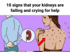 10 Early Signs Your Kidneys May Need Attention