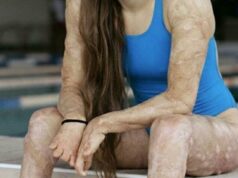 SOTD – These are the consequences of sleeping co! See now