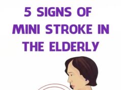 Early Signs of a Mini-Stroke in Seniors You Should Know