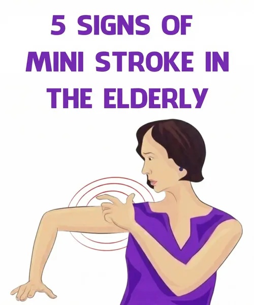 5 signs of mini str0ke in the elderly Check 1st comment 👇😱‼️