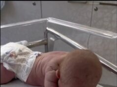 Baby born with an DIU peg – See now!