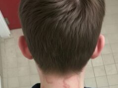 My 8 year old son been having this for 2 months straight it’s gotten worse from the first time he had this.. What is it