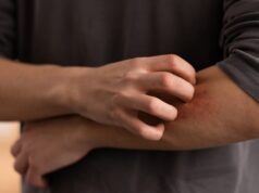 Don’t overlook these small red spots on your arm – They could be important warning signs
