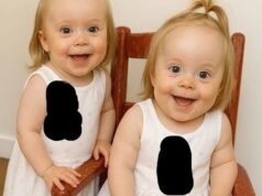 Young woman puts both babies inside the fir! See now