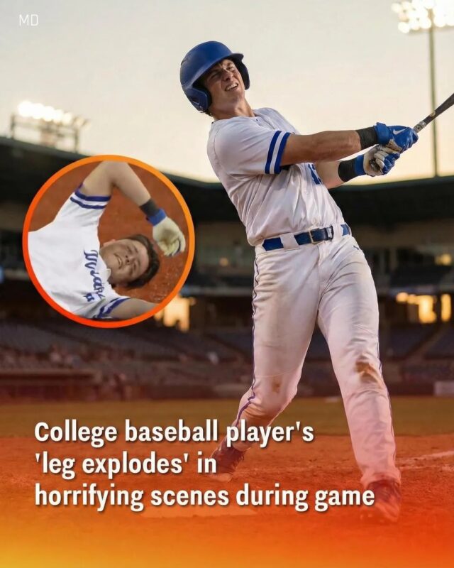 Even the commentators sounded horrified. It was replayed in slow-motion... 🤮