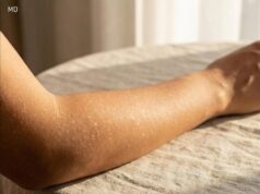 What Small White Spots on Your Arms or Legs Could Mean
