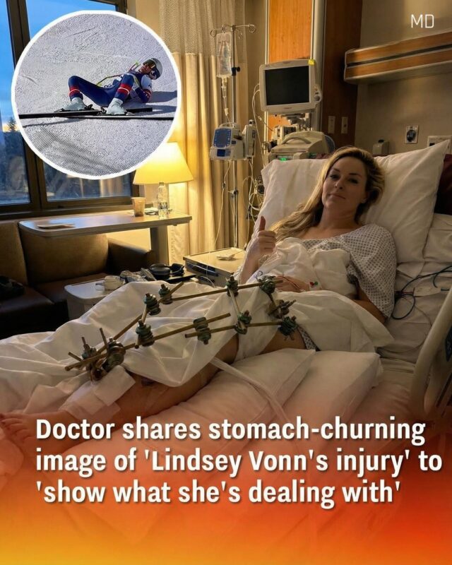The Olympian's had three surgeries since the devastating crash.