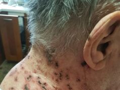 This is the silent disease that is triggered when you come into contact with! See now