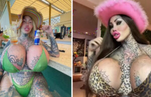 Tragic update on surgery-addicted woman who wanted to become a”forest elf”