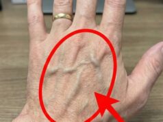 If you have visible veins, it means you are…