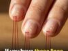 Why Vertical Nail Ridges Become More Noticeable as You Get Older