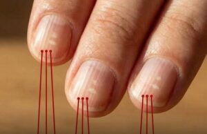Why Vertical Nail Ridges Become More Noticeable as You Get Older