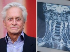 Expert reveals why HPV-related throat cancer is rising among men due to oral sex