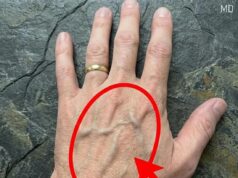 What Visible Veins Really Mean About Your Body