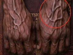 What Visible Veins on Your Hands May Say About Your Circulation and Overall Health