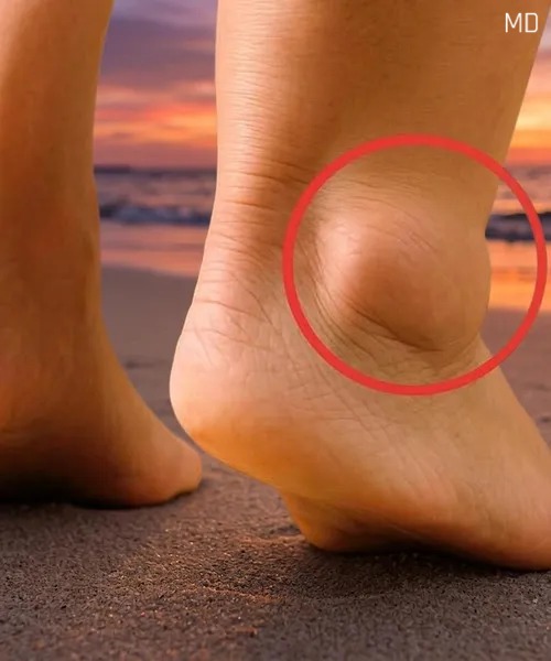 If you notice your legs are swollen, that's a sign of ca...See more in 1st comment 👇👇.