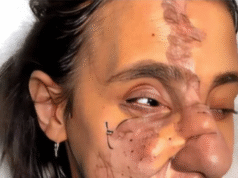 She Lived in the Shadows for 30 Years, Until a Makeup Artist Helped Her Shine!