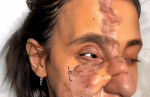 She Lived in the Shadows for 30 Years, Until a Makeup Artist Helped Her Shine!