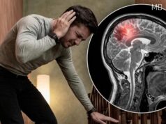 Important Warning Signs of Aneurysm in Men You Should Be Aware Of