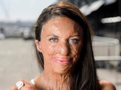 These are the consequences of sleeping with it! See it! sotd?