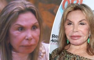 Elsa Patton’s face was ‘ruined’ by plastic surgeon: Pictures of the reality star shows how beautiful she was before