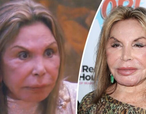 Elsa Patton’s face was ‘ruined’ by plastic surgeon: Pictures of the reality star shows how beautiful she was before