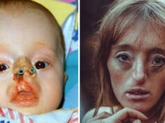 Ilka Brühl was born with rare facial defect – now she’s breaking beauty standards with her modeling career