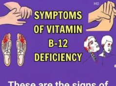 Common Signs and Symptoms of Vitamin B12 Deficiency