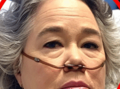 PRAY FOR KATHY BATES HEALTH!