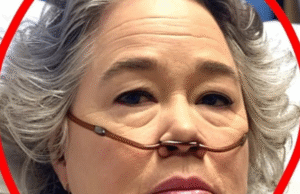 PRAY FOR KATHY BATES HEALTH!