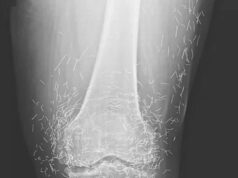 The Golden Trap Why One Womans Routine X Ray Left Medical Experts In Total Disbelief