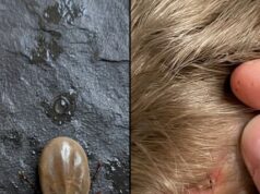 Terrified Parents Warned After Crucial Discovery In Childs Hair Reveals Hidden Medical Nightmare