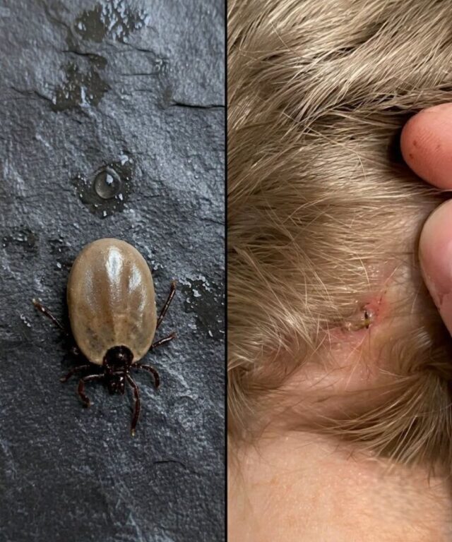 Does anyone know what kind of insect this is- I just found it on my son's head... Check 1st comment 👇👇