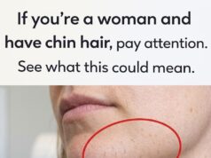 Understanding Facial Hair in Women: Causes, Changes, and Care Options