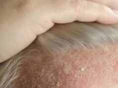 This Common Nighttime Habit Will Destroy Your Scalp And You Are Doing It Every Day