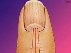 What Those Vertical Lines on Your Nails May Be Telling You About Aging