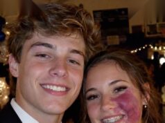 Only One Boy Asked Me to Prom Because No One Else Wanted to Due to the Birthmark on My Face – Everyone Laughed Until an Officer Walked Into the Hall